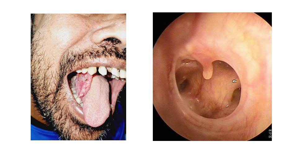 Receiving an award or certificate